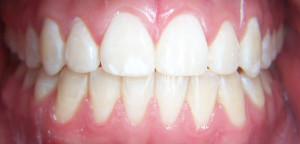 Orthodontics After 1