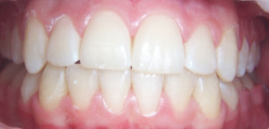 Orthodontics After 2