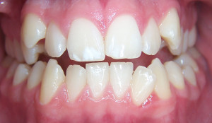 Orthodontics Before 1