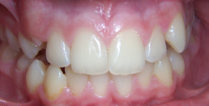 Orthodontics Before 2